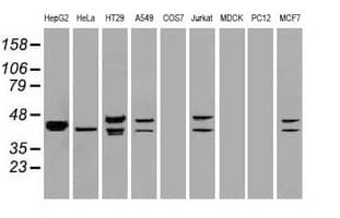 Monoclonal Mouse anti-Human DFFA / ICAD / DFF45 Antibody (clone OTI5C4, IF, WB)