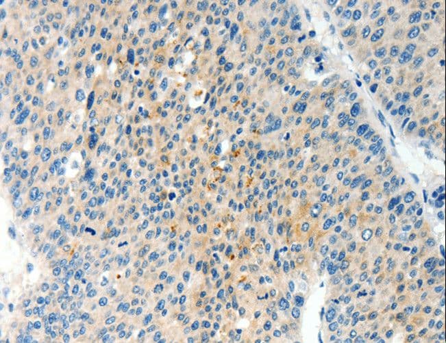 TPM2 Antibody