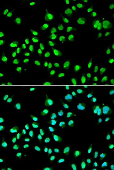RAP30 / GTF2F2 Antibody