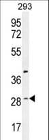 C19orf38 Antibody (aa129-158)