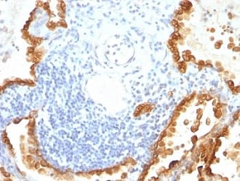 Cytokeratin 8+18 Antibody (clone KRT8/803 + KRT18/835)