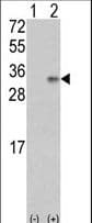 Polyclonal Rabbit anti-Human VEGFB Antibody (aa110-139, IHC, WB)