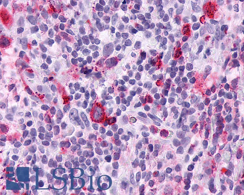 PathPlus™ Leukotriene B4 Receptor / BLT1 Antibody (Cytoplasmic Domain)