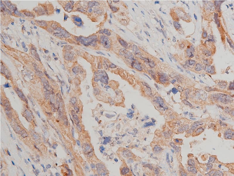 MTOR Antibody (phospho-Ser2448)