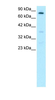 Polyclonal Rabbit anti-Human FOXE3 Antibody (aa235-284, IHC, WB)