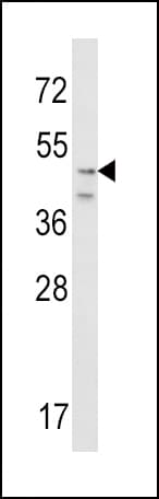 Polyclonal Rabbit anti-Human CRHR2 / CRF2 Receptor Antibody (aa84-114, IHC, WB)