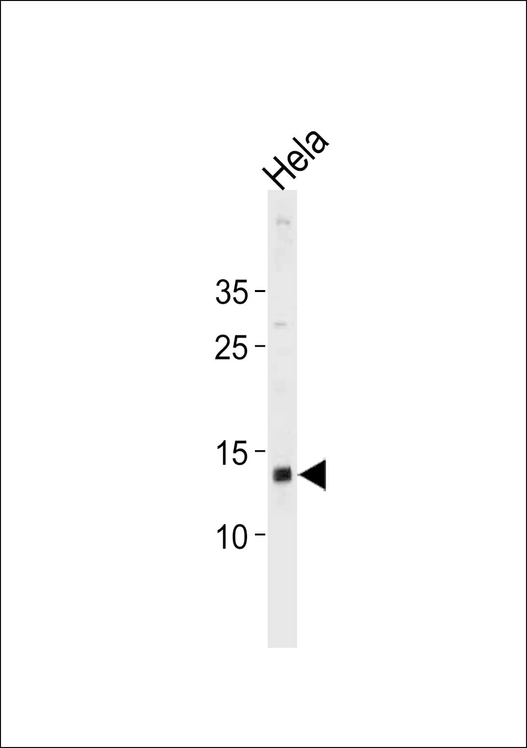 DAP Antibody (aa10-38)