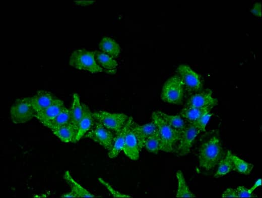 SEMA6A / Semaphorin 6A Antibody