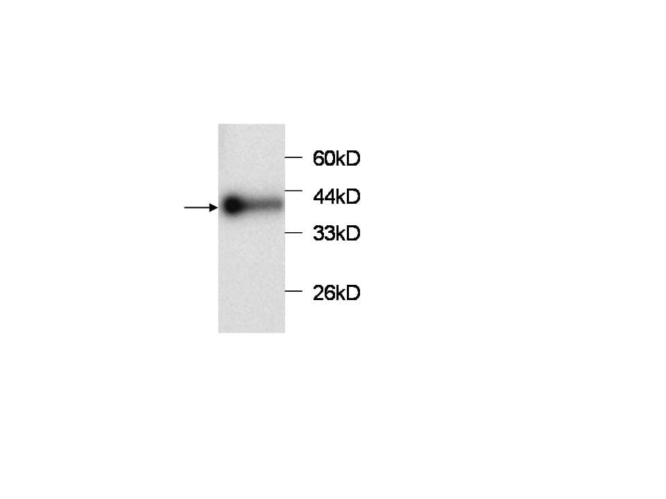 CCL2 / MCP1 Antibody