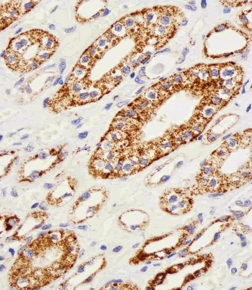 GLS / Glutaminase Antibody (aa516-545)