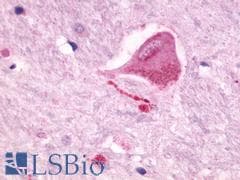 PathPlus™ NMUR2 Antibody (Cytoplasmic Domain)