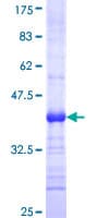 Human EDA2R / XEDAR Protein (Recombinant GST, N-terminus)