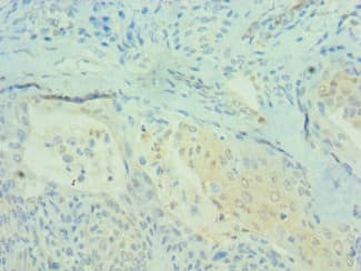 PDCD4 Antibody (aa1-260)