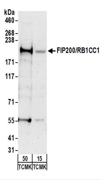 RB1CC1 / CC1 Antibody (aa1544-1594)