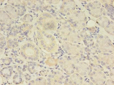 Polyclonal Rabbit anti-Human TBCA Antibody (IHC)