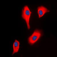 Polyclonal Rabbit anti-Human GK2 / Glycerol Kinase 2 Antibody (Internal, IF, WB)