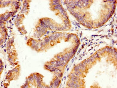 TNNI3 / Cardiac Troponin I Antibody