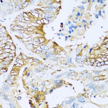 Polyclonal Rabbit anti-Human Apolipoprotein C-I Antibody (IHC, WB)