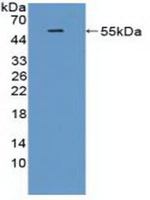 TREM2 / TREM-2 Antibody (aa1-228)
