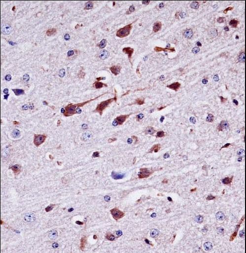 Polyclonal Rabbit anti-Mouse PTK2B / PYK2 Antibody (aa672-701, IHC, WB)