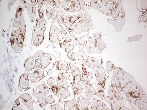 Monoclonal Mouse anti-Human NCAM / CD56 Antibody (clone OTI1B9, aa20-718, IHC, WB)