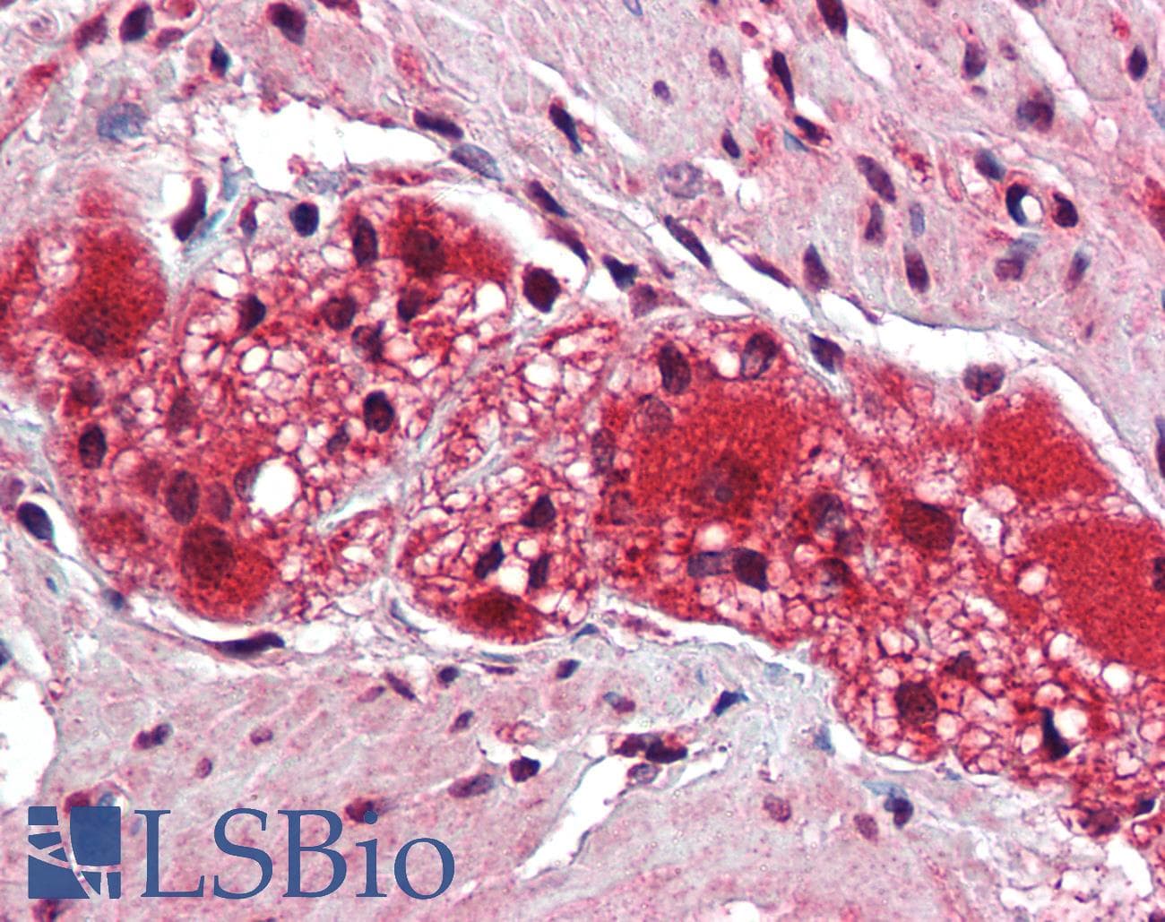 KDM2B / FBXL10 Antibody (C-Terminus)