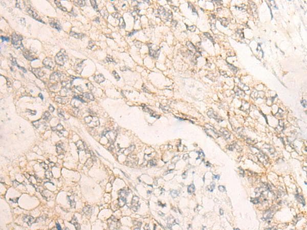 Polyclonal Rabbit anti-Human DMTN / Dematin Antibody (IHC, WB)
