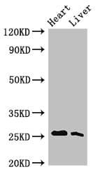 TNNI3 / Cardiac Troponin I Antibody (aa2-211)