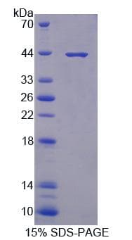 Rat PRKX Protein (Recombinant His-T7)
