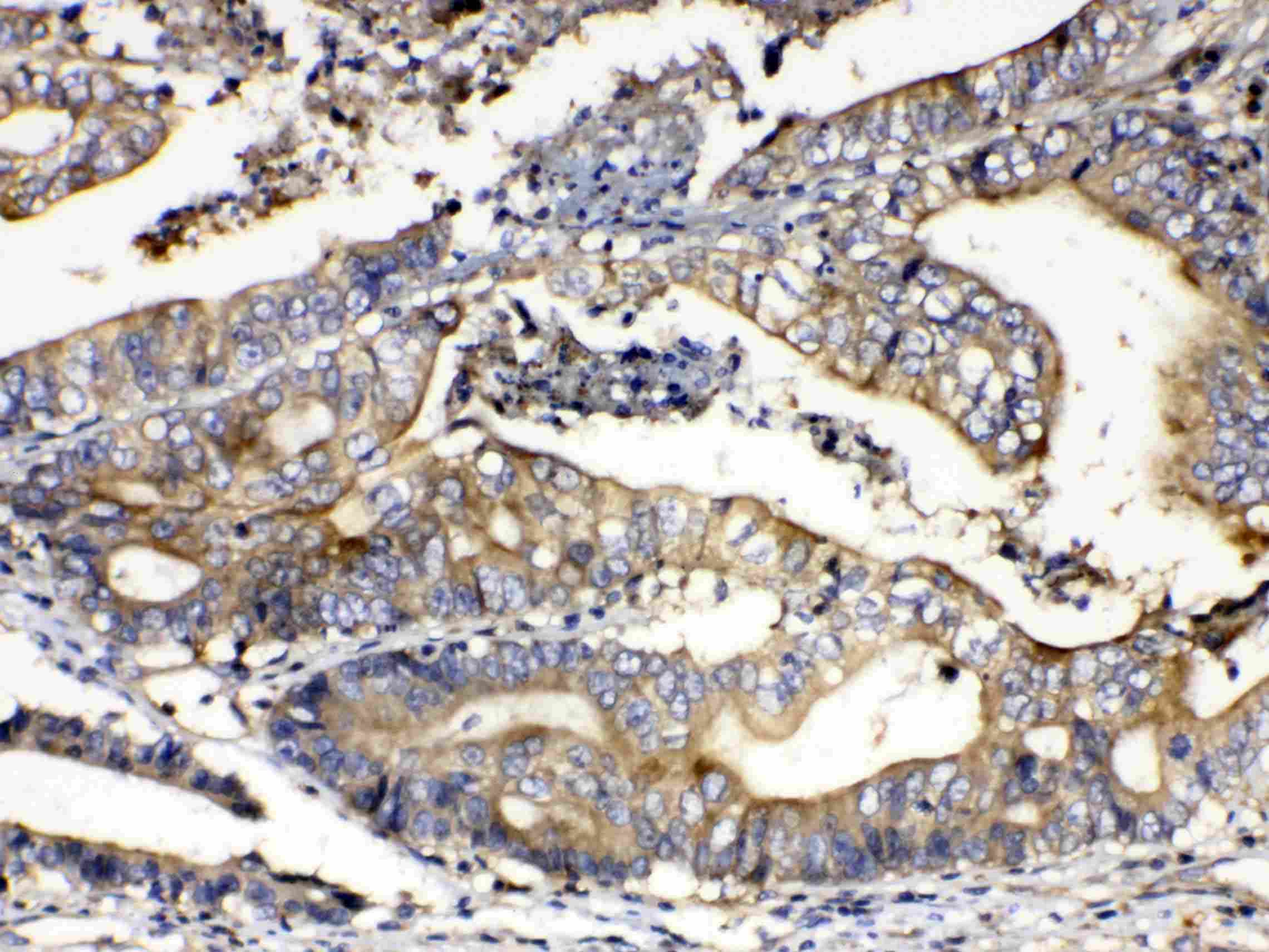 CAPN2 / Calpain 2 / M-Calpain Antibody
