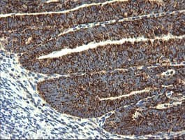 Monoclonal Mouse anti-Human GBAS Antibody (clone 1B8, Carrier-free, IHC, IF, WB)