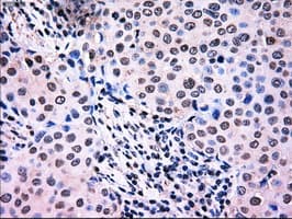 NRBP1 / NRBP Antibody (clone OTI4C1)