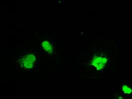 Monoclonal Mouse anti-Human SSB / La Antibody (clone OTI6G7, IHC, IF, WB)
