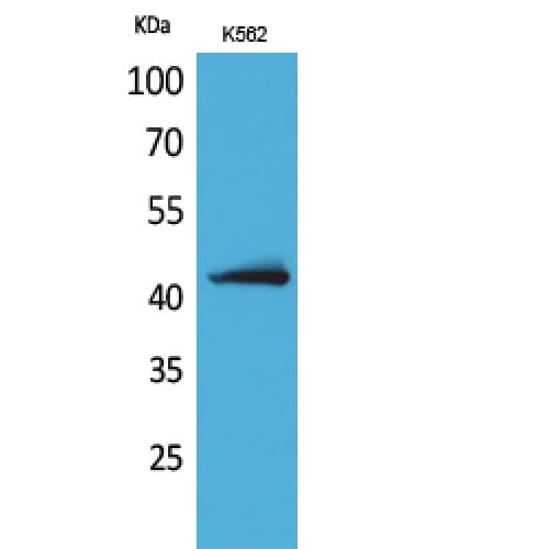 JAM2 Antibody (Internal)