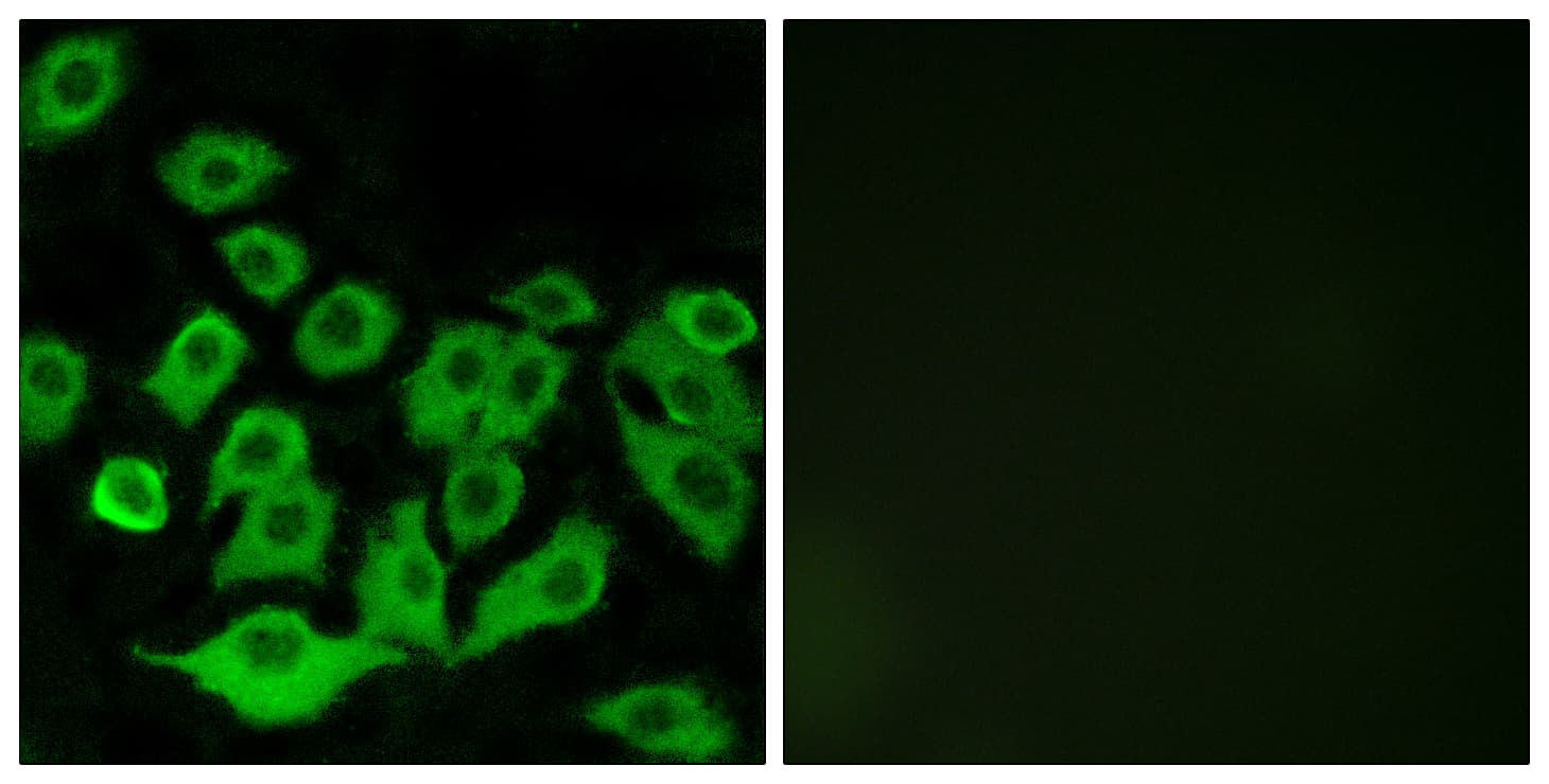 RPL36 / Ribosomal Protein L36 Antibody (aa51-100)