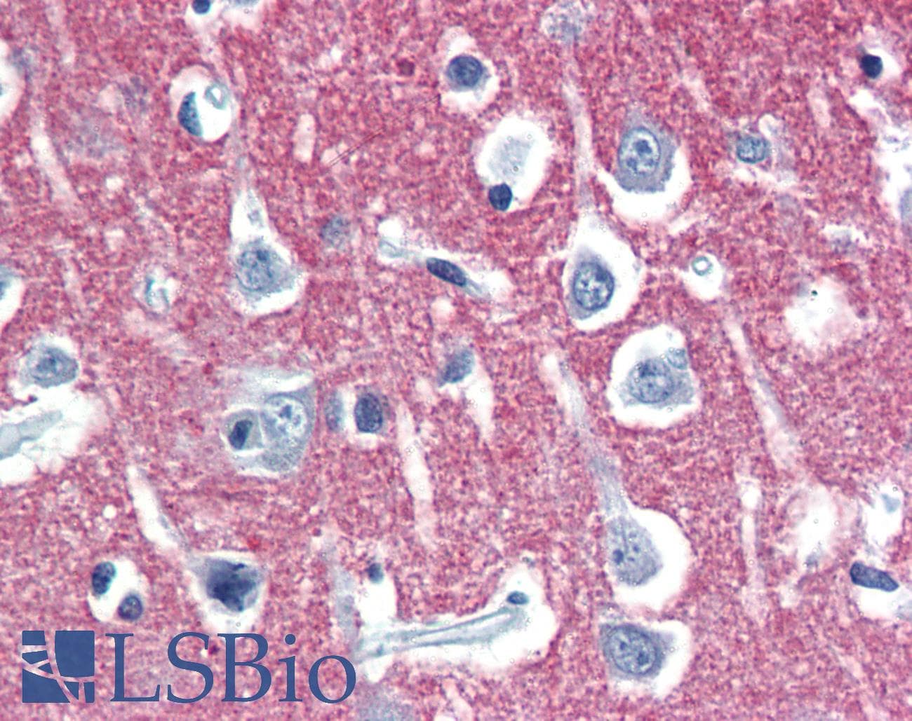 IHC-plus™ RAB3A Antibody (aa202-217)