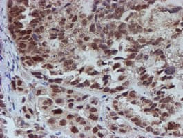 ATRIP Antibody (clone OTI5E7)