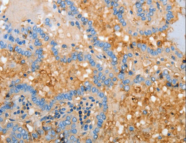 Polyclonal Rabbit anti-Human APOH / Apolipoprotein H Antibody (aa21-226, IHC, WB)