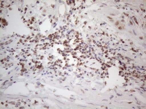 WTAP Antibody (aa2-106, clone OTI6H3)