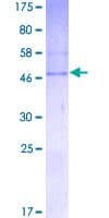 Human CBR4 Protein (Recombinant GST)