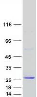 Human CLEC3B / Tetranectin Protein (Recombinant Myc-DDK (Flag))