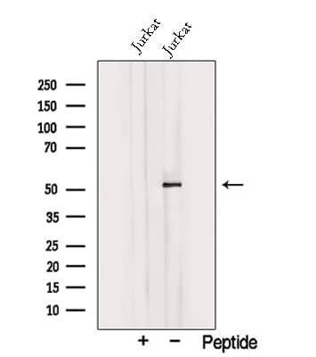 TRIM15 Antibody