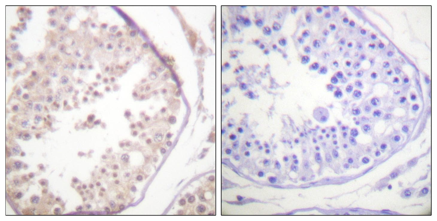 Polyclonal Rabbit anti-Human RAD52 Antibody (p104, IHC, IF, WB)
