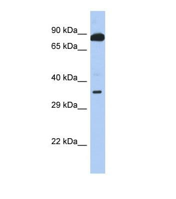 TEX9 Antibody (aa109-158)