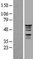 KATNAL1 Protein (Over-Expression Lysate Myc-DDK (Flag))