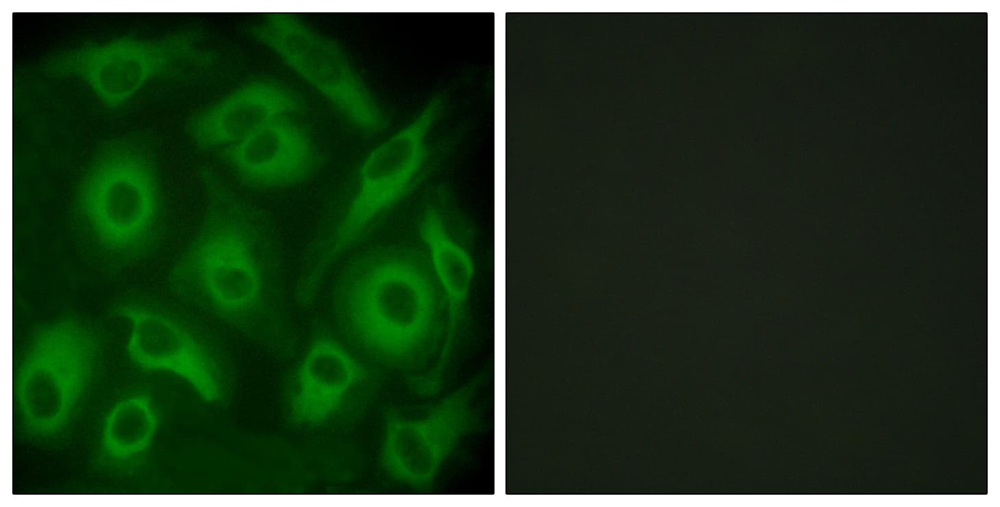 IHC-plus™ CDH23 / Cadherin 23 Antibody (aa61-110)