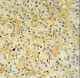 Polyclonal Rabbit anti-Human DAZAP2 Antibody (aa111-139, IHC, WB)