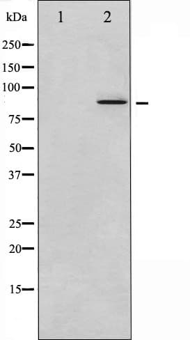 NR3C1/Glucocorticoid Receptor Antibody (phospho-Ser203)