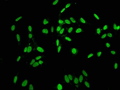 HIST1H1C Antibody (phospho-Thr164)