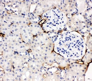 Polyclonal Rabbit anti-Human Adiponectin Antibody (aa224-244, IHC, WB)